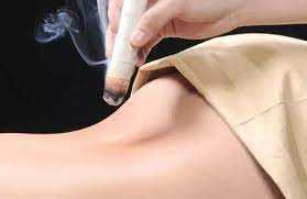 45Min Moxibustion