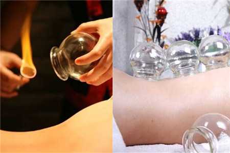 Cupping(specific services are subject to actual arrival at the store)