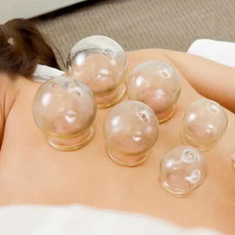 ADD ON - 20mins Cupping Therapy