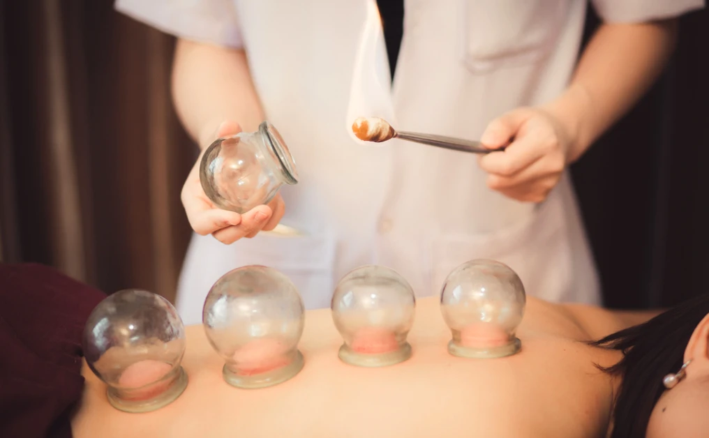 Cupping With Massage