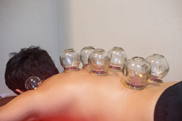 Cupping